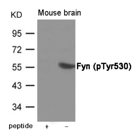 Western blot - Fyn (Phospho-Tyr530) Antibody from Signalway Antibody (12008) - Antibodies.com