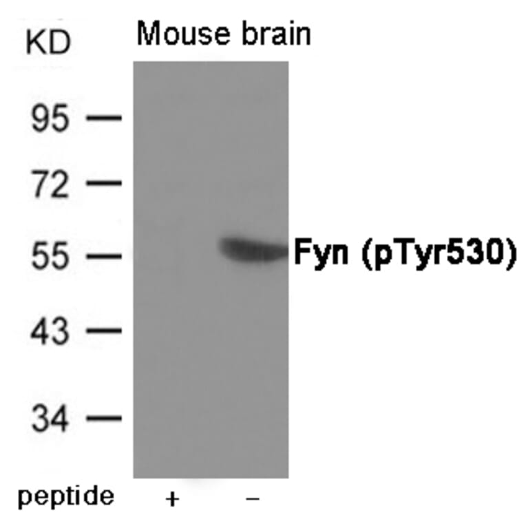 Western blot - Fyn (Phospho-Tyr530) Antibody from Signalway Antibody (12008) - Antibodies.com