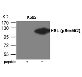 Western blot - HSL (Phospho-Ser552) Antibody from Signalway Antibody (12010) - Antibodies.com