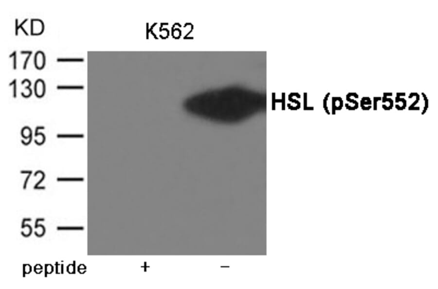 Western blot - HSL (Phospho-Ser552) Antibody from Signalway Antibody (12010) - Antibodies.com