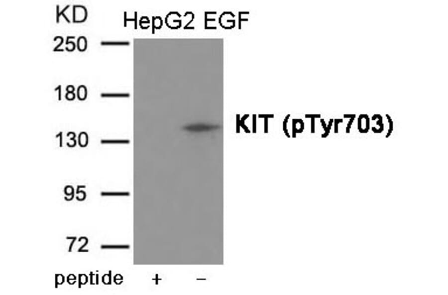 Western blot - KIT (Phospho-Tyr703) Antibody from Signalway Antibody (12017) - Antibodies.com