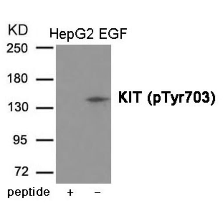 Western blot - KIT (Phospho-Tyr703) Antibody from Signalway Antibody (12017) - Antibodies.com