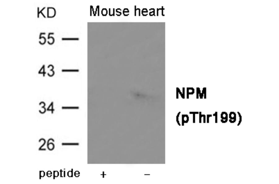 Western blot - NPM (Phospho-Thr199) Antibody from Signalway Antibody (12031) - Antibodies.com