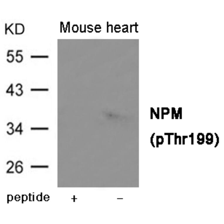 Western blot - NPM (Phospho-Thr199) Antibody from Signalway Antibody (12031) - Antibodies.com