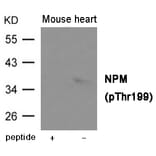 Western blot - NPM (Phospho-Thr199) Antibody from Signalway Antibody (12031) - Antibodies.com