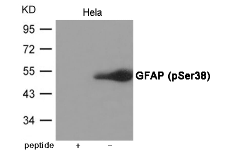 Western blot - GFAP (Phospho-Ser38) Antibody from Signalway Antibody (12056) - Antibodies.com
