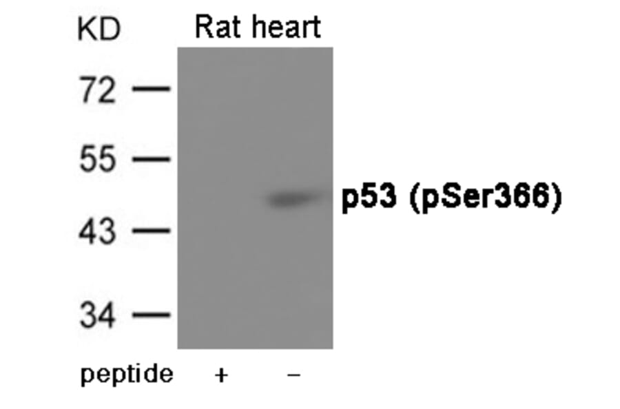 Western blot - p53 (Phospho-Ser366) Antibody from Signalway Antibody (12063) - Antibodies.com