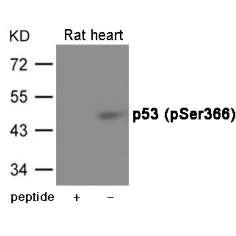 Western blot - p53 (Phospho-Ser366) Antibody from Signalway Antibody (12063) - Antibodies.com
