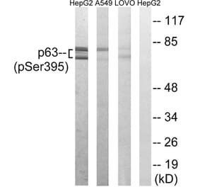 Western blot - p63 (Phospho-Ser395) Antibody from Signalway Antibody (12149) - Antibodies.com