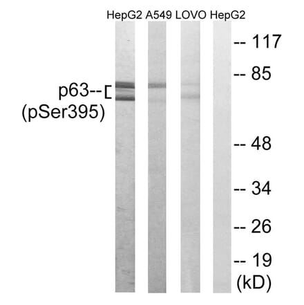 Western blot - p63 (Phospho-Ser395) Antibody from Signalway Antibody (12149) - Antibodies.com