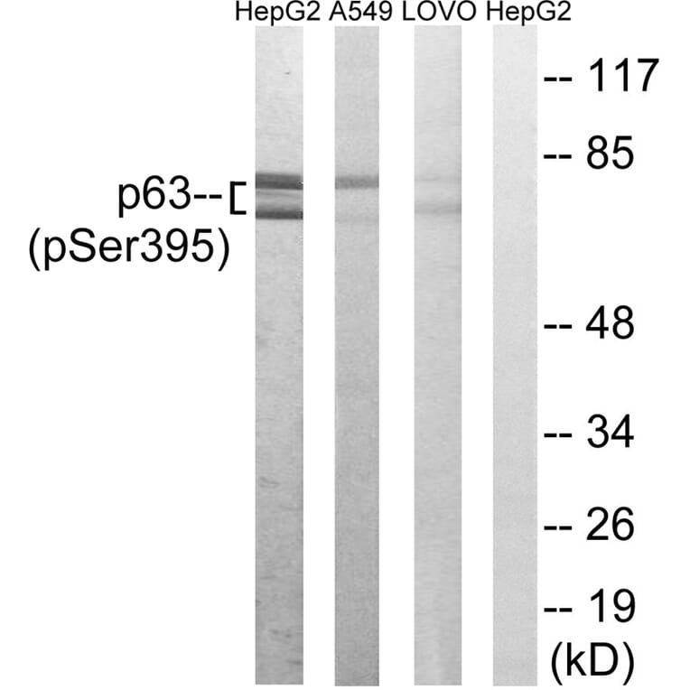 Western blot - p63 (Phospho-Ser395) Antibody from Signalway Antibody (12149) - Antibodies.com