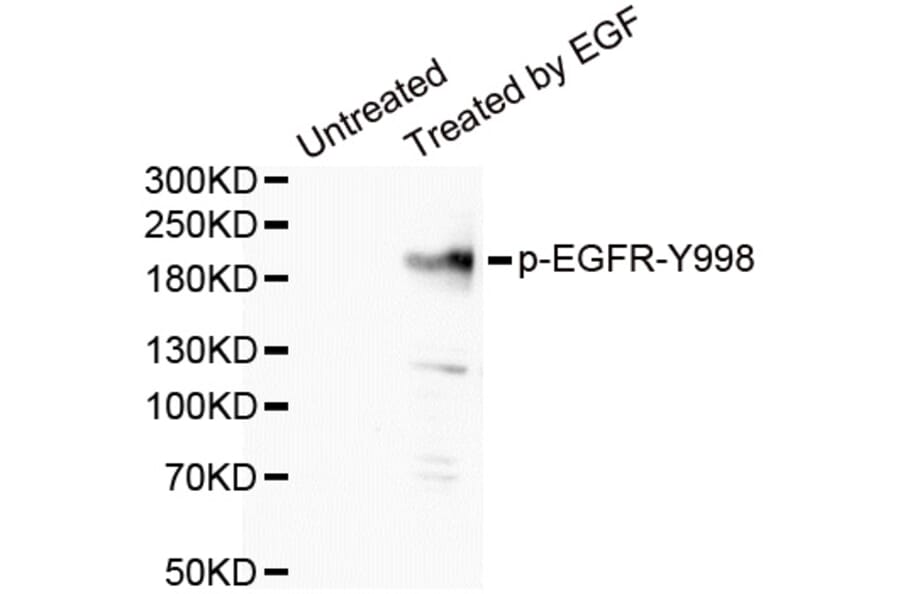Western blot - EGFR (Phospho-Tyr998) antibody from Signalway Antibody (12161) - Antibodies.com