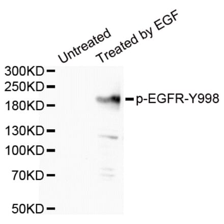 Western blot - EGFR (Phospho-Tyr998) antibody from Signalway Antibody (12161) - Antibodies.com