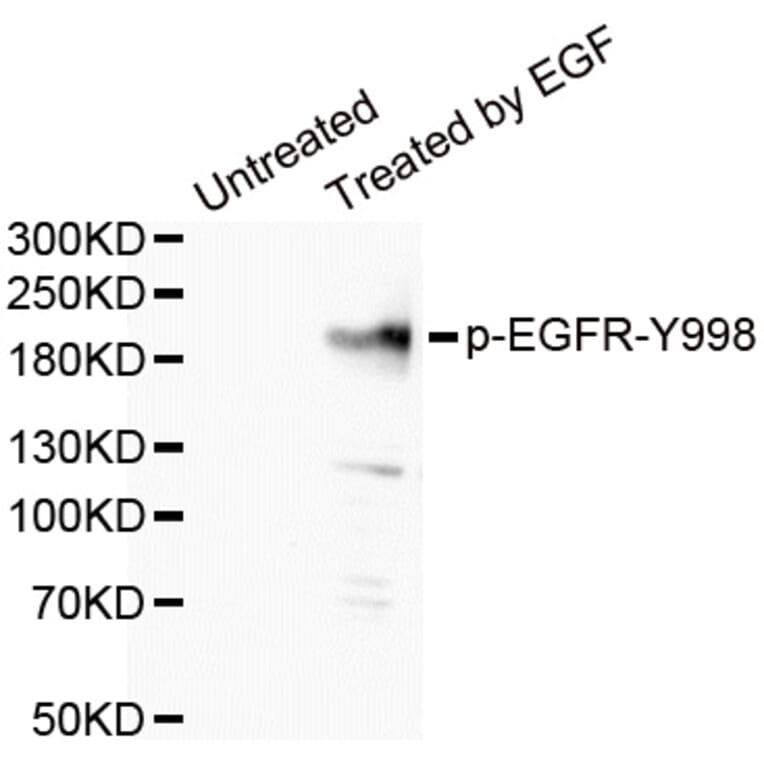 Western blot - EGFR (Phospho-Tyr998) antibody from Signalway Antibody (12161) - Antibodies.com