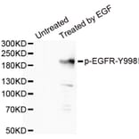 Western blot - EGFR (Phospho-Tyr998) antibody from Signalway Antibody (12161) - Antibodies.com