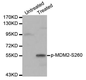 Western blot - MDM2 (Phospho-Ser260) antibody from Signalway Antibody (12171) - Antibodies.com