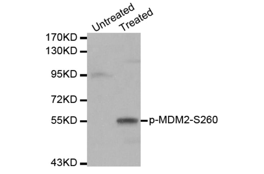 Western blot - MDM2 (Phospho-Ser260) antibody from Signalway Antibody (12171) - Antibodies.com