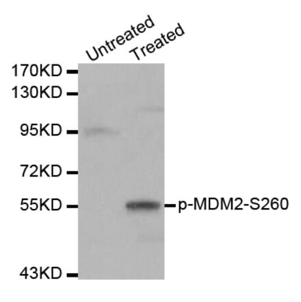 Western blot - MDM2 (Phospho-Ser260) antibody from Signalway Antibody (12171) - Antibodies.com