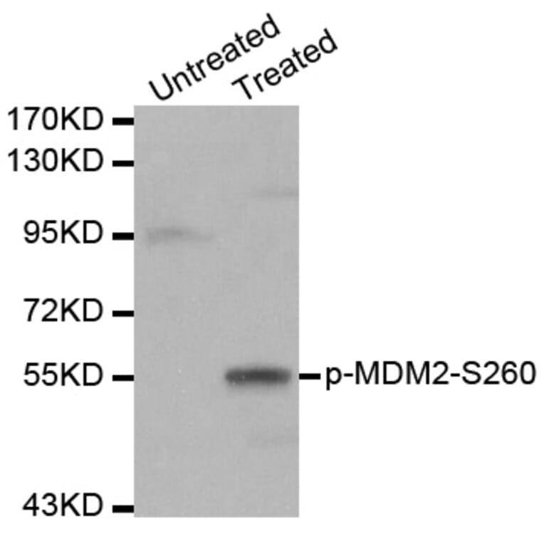 Western blot - MDM2 (Phospho-Ser260) antibody from Signalway Antibody (12171) - Antibodies.com
