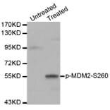 Western blot - MDM2 (Phospho-Ser260) antibody from Signalway Antibody (12171) - Antibodies.com