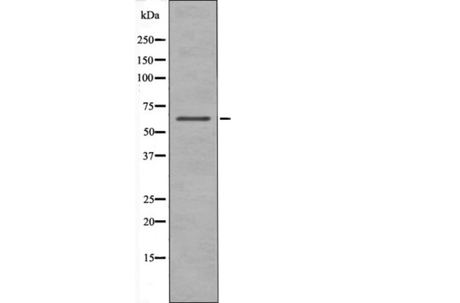 Western blot - Chk2 (Phospho-Ser19) Antibody from Signalway Antibody (12413) - Antibodies.com