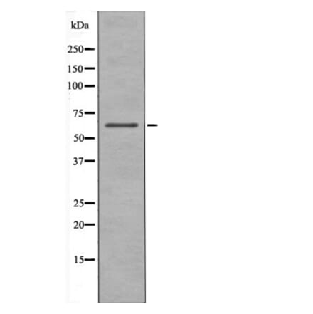 Western blot - Chk2 (Phospho-Ser19) Antibody from Signalway Antibody (12413) - Antibodies.com