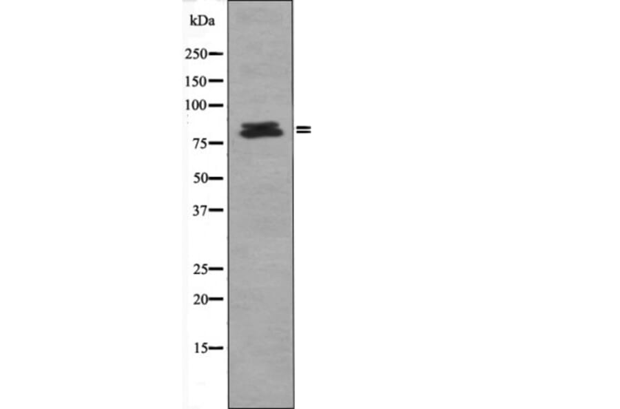 Western blot - HSL (Phospho-Ser660) Antibody from Signalway Antibody (12416) - Antibodies.com
