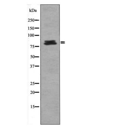Western blot - HSL (Phospho-Ser660) Antibody from Signalway Antibody (12416) - Antibodies.com