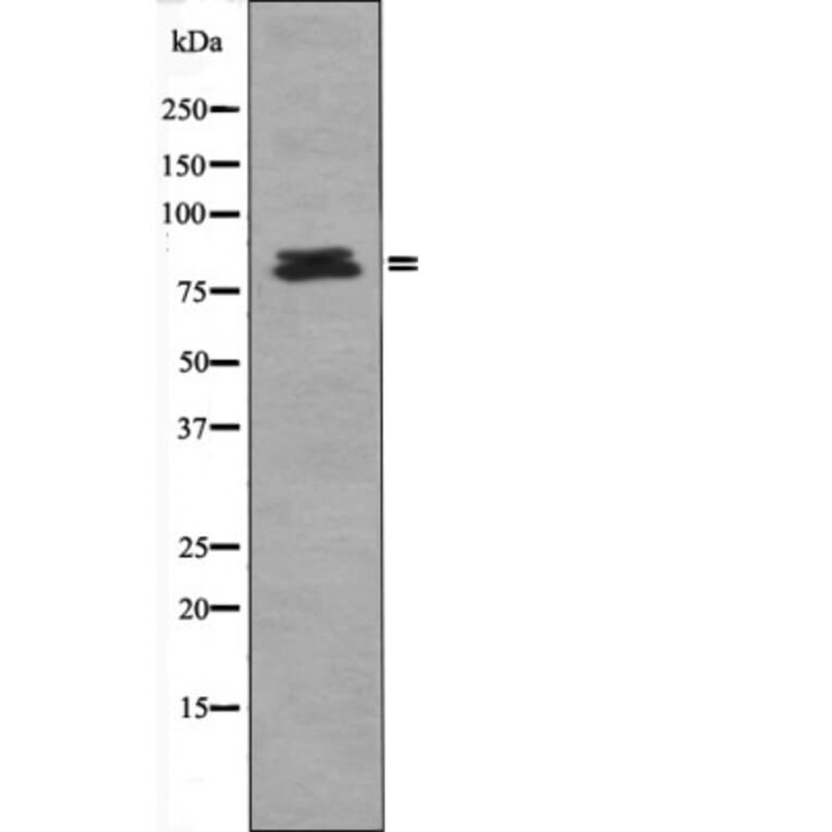 Western blot - HSL (Phospho-Ser660) Antibody from Signalway Antibody (12416) - Antibodies.com