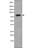 Western blot - HSL (Phospho-Ser660) Antibody from Signalway Antibody (12416) - Antibodies.com