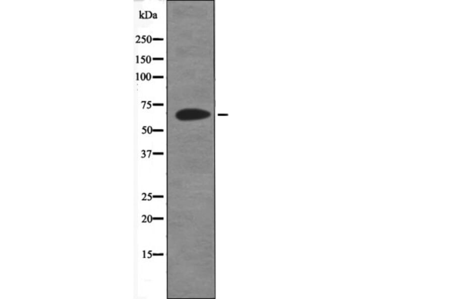 Western blot - ITK (Phospho-Tyr512) Antibody from Signalway Antibody (12445) - Antibodies.com