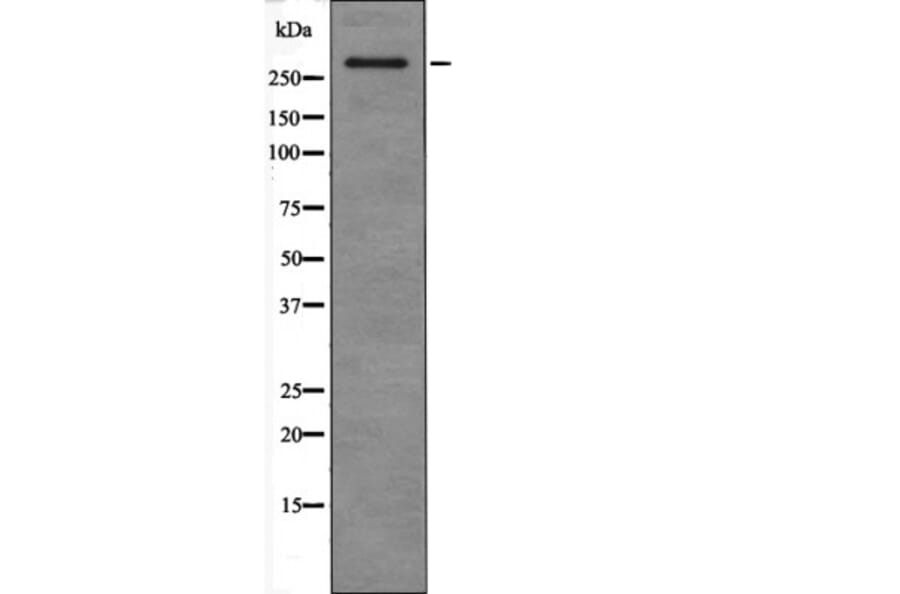 Western blot - ATM (Phospho-Ser367) Antibody from Signalway Antibody (12465) - Antibodies.com
