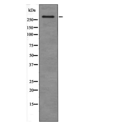 Western blot - ATM (Phospho-Ser367) Antibody from Signalway Antibody (12465) - Antibodies.com