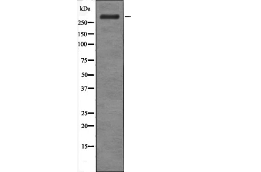 Western blot - ATM (Phospho-Ser183) Antibody from Signalway Antibody (12466) - Antibodies.com