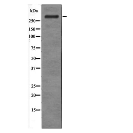 Western blot - ATM (Phospho-Ser183) Antibody from Signalway Antibody (12466) - Antibodies.com