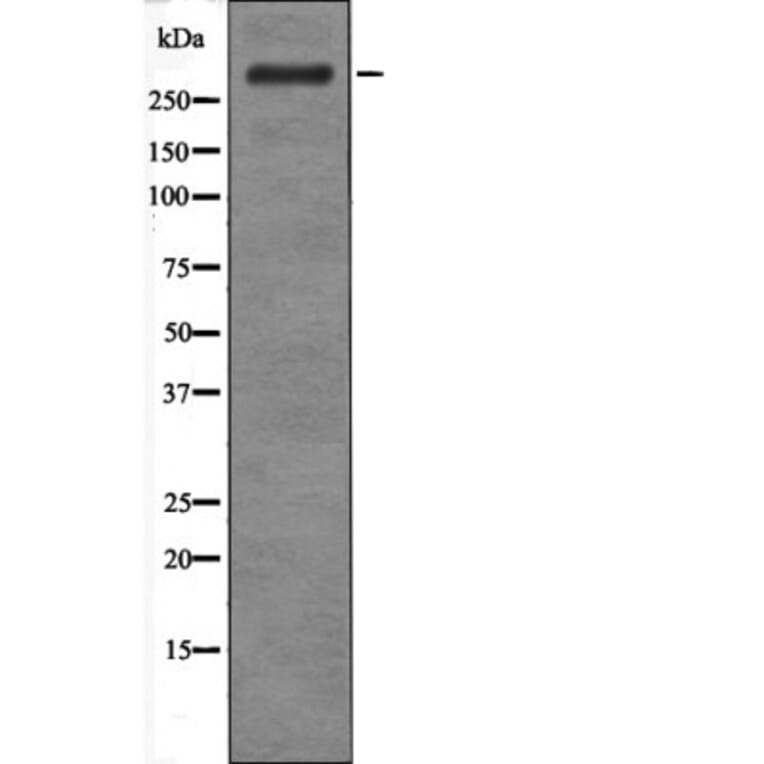 Western blot - ATM (Phospho-Ser183) Antibody from Signalway Antibody (12466) - Antibodies.com