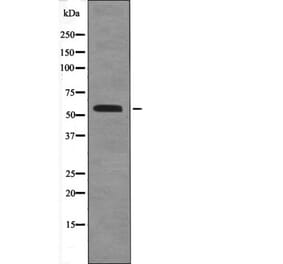 Western blot - BLK (Phospho-Tyr389) Antibody from Signalway Antibody (12489) - Antibodies.com