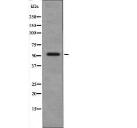 Western blot - CSK (Phospho-Tyr304) Antibody from Signalway Antibody (12494) - Antibodies.com