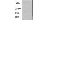 Western blot - FGR (Phospho-Tyr412) Antibody from Signalway Antibody (12506) - Antibodies.com