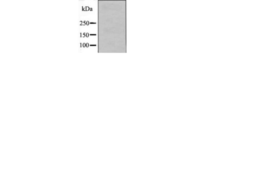 Western blot - FGR (Phospho-Tyr412) Antibody from Signalway Antibody (12506) - Antibodies.com