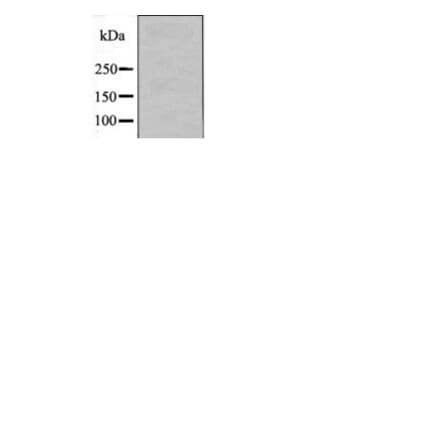 Western blot - FGR (Phospho-Tyr412) Antibody from Signalway Antibody (12506) - Antibodies.com