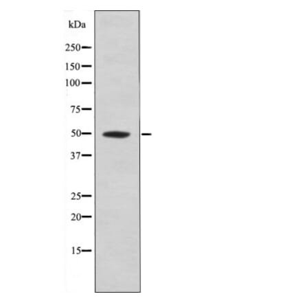 Western blot - MOK (Phospho-Tyr161) Antibody from Signalway Antibody (12518) - Antibodies.com