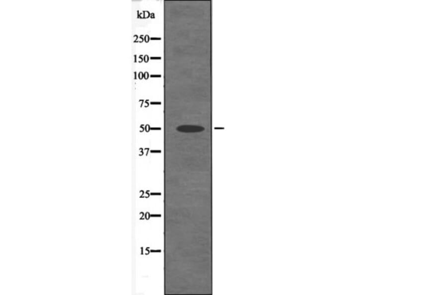 Western blot - MST3 (Phospho-Thr18) Antibody from Signalway Antibody (12520) - Antibodies.com