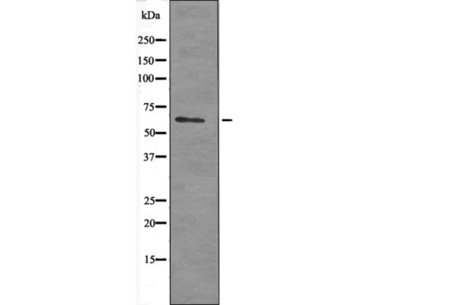 Western blot - PAK1 (Phospho-Ser21) Antibody from Signalway Antibody (12525) - Antibodies.com