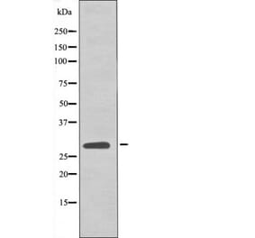 Western blot - LAT (Phospho-Tyr161) Antibody from Signalway Antibody (12541) - Antibodies.com
