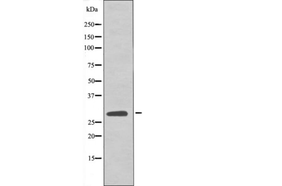 Western blot - LAT (Phospho-Tyr161) Antibody from Signalway Antibody (12541) - Antibodies.com