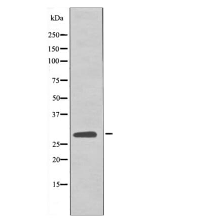 Western blot - LAT (Phospho-Tyr161) Antibody from Signalway Antibody (12541) - Antibodies.com
