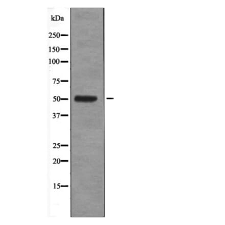 Western blot - Fos (Phospho-Ser374) Antibody from Signalway Antibody (12599) - Antibodies.com