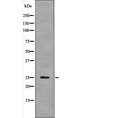 Western blot analysis LAB (Phospho-Tyr136) using HuvEc whole cell lysates