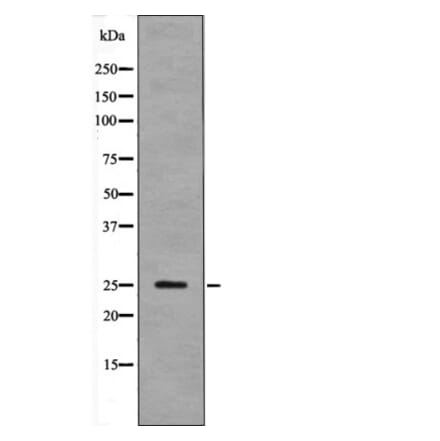 Western blot - LAB (Phospho-Tyr136) Antibody from Signalway Antibody (12607) - Antibodies.com
